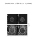 MeCP2 ISOFORM-SPECIFIC ANTIBODY FOR DETECTION OF ENDOGENOUS EXPRESSION OF     MeCP2E1 diagram and image