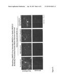 LINGO-2 ANTAGONISTS FOR TREATMENT OF CONDITIONS INVOLVING MOTOR NEURONS diagram and image