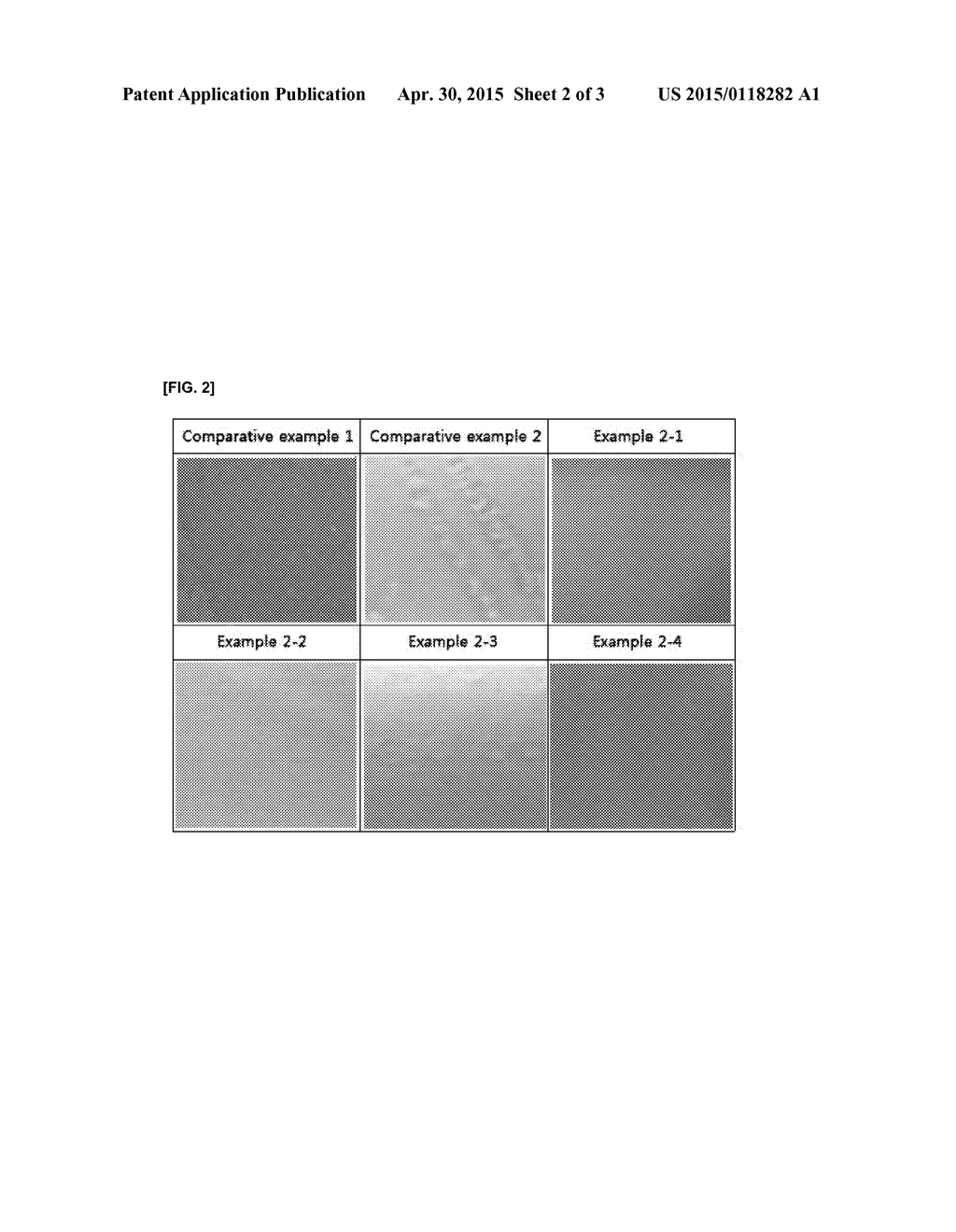 TRANSDERMALLY ABSORBABLE PREPARATION CONTAINING ROTIGOTINE - diagram, schematic, and image 03