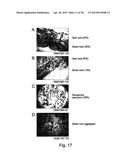 EXTRACELLULAR MATRIX-SYNTHETIC SKIN SCAFFOLD diagram and image