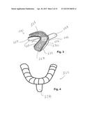 Intraoral Imaging Apparatus diagram and image