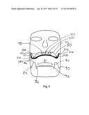 Intraoral Imaging Apparatus diagram and image