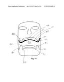 Intraoral Imaging Apparatus diagram and image