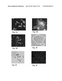 RETINAL PIGMENT EPITHELIAL CELLS DIFFERENTIATED FROM EMBRYONIC STEM CELLS     WITH NICOTINAMIDE AND ACTIVIN A diagram and image