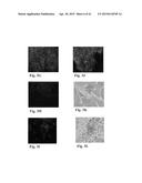 RETINAL PIGMENT EPITHELIAL CELLS DIFFERENTIATED FROM EMBRYONIC STEM CELLS     WITH NICOTINAMIDE AND ACTIVIN A diagram and image