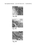 RETINAL PIGMENT EPITHELIAL CELLS DIFFERENTIATED FROM EMBRYONIC STEM CELLS     WITH NICOTINAMIDE AND ACTIVIN A diagram and image