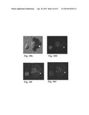 RETINAL PIGMENT EPITHELIAL CELLS DIFFERENTIATED FROM EMBRYONIC STEM CELLS     WITH NICOTINAMIDE AND ACTIVIN A diagram and image