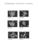 RETINAL PIGMENT EPITHELIAL CELLS DIFFERENTIATED FROM EMBRYONIC STEM CELLS     WITH NICOTINAMIDE AND ACTIVIN A diagram and image