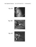 RETINAL PIGMENT EPITHELIAL CELLS DIFFERENTIATED FROM EMBRYONIC STEM CELLS     WITH NICOTINAMIDE AND ACTIVIN A diagram and image