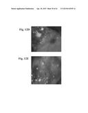 RETINAL PIGMENT EPITHELIAL CELLS DIFFERENTIATED FROM EMBRYONIC STEM CELLS     WITH NICOTINAMIDE AND ACTIVIN A diagram and image