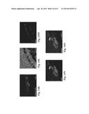 RETINAL PIGMENT EPITHELIAL CELLS DIFFERENTIATED FROM EMBRYONIC STEM CELLS     WITH NICOTINAMIDE AND ACTIVIN A diagram and image