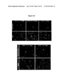 INHIBITION OF COLONY STIMULATING FACTOR-1 RECEPTOR SIGNALING FOR THE     TREATMENT OF BRAIN CANCER diagram and image