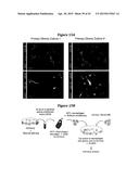 INHIBITION OF COLONY STIMULATING FACTOR-1 RECEPTOR SIGNALING FOR THE     TREATMENT OF BRAIN CANCER diagram and image