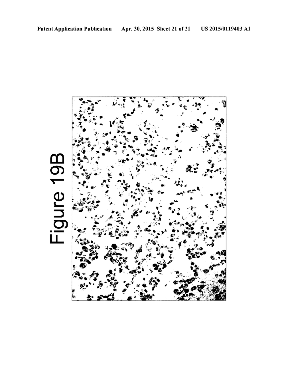 Mutant ROS Expression In Human Cancer - diagram, schematic, and image 22