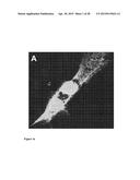 NANOPARTICLES WITH ATTACHED DNA REPAIR INHIBITORS AND NUCLEAR LOCALISATION     SIGNAL ELEMENTS diagram and image