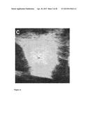 NANOPARTICLES WITH ATTACHED DNA REPAIR INHIBITORS AND NUCLEAR LOCALISATION     SIGNAL ELEMENTS diagram and image