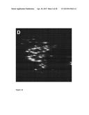 NANOPARTICLES WITH ATTACHED DNA REPAIR INHIBITORS AND NUCLEAR LOCALISATION     SIGNAL ELEMENTS diagram and image