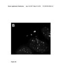 NANOPARTICLES WITH ATTACHED DNA REPAIR INHIBITORS AND NUCLEAR LOCALISATION     SIGNAL ELEMENTS diagram and image