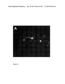 NANOPARTICLES WITH ATTACHED DNA REPAIR INHIBITORS AND NUCLEAR LOCALISATION     SIGNAL ELEMENTS diagram and image