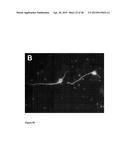 NANOPARTICLES WITH ATTACHED DNA REPAIR INHIBITORS AND NUCLEAR LOCALISATION     SIGNAL ELEMENTS diagram and image