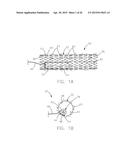 INTRAVASCULAR DEVICE ATTACHMENT SYSTEM HAVING BIOLOGICAL MATERIAL diagram and image