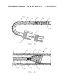 INTRAVASCULAR DEVICE ATTACHMENT SYSTEM HAVING BIOLOGICAL MATERIAL diagram and image