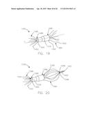 INTRAVASCULAR DEVICE ATTACHMENT SYSTEM HAVING BIOLOGICAL MATERIAL diagram and image