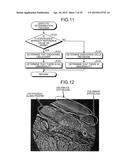 IMAGE PROCESSING APPARATUS, MICROSCOPE SYSTEM, ENDOSCOPE SYSTEM, AND IMAGE     PROCESSING METHOD diagram and image