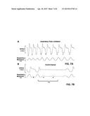 WHOLE-BODY PLETYSMOGRAPHY SYSTEM FOR THE CONTINUOUS CHARACTERIZATION OF     SLEEP AND BREATHING IN A MOUSE diagram and image