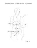 Feedback System For Brace-Based Equipment diagram and image