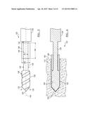 Method And Apparatus For Forming A Bone Hole diagram and image