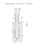 Method And Apparatus For Forming A Bone Hole diagram and image