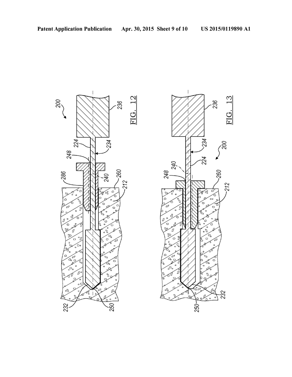 Method And Apparatus For Forming A Bone Hole - diagram, schematic, and image 10