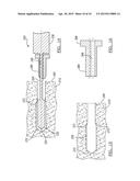 Method And Apparatus For Forming A Bone Hole diagram and image