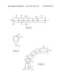 REENTRY CATHETER AND METHOD THEREOF diagram and image