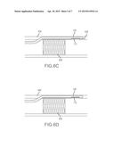 REENTRY CATHETER AND METHOD THEREOF diagram and image