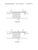 REENTRY CATHETER AND METHOD THEREOF diagram and image