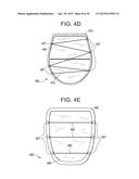 VASCULATURE CLOSURE METHODS diagram and image