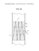 VASCULATURE CLOSURE METHODS diagram and image