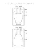 VASCULATURE CLOSURE METHODS diagram and image