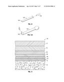 SYSTEM AND METHOD FOR PERFORMING MINIMALLY INVASIVE FACELIFTS diagram and image