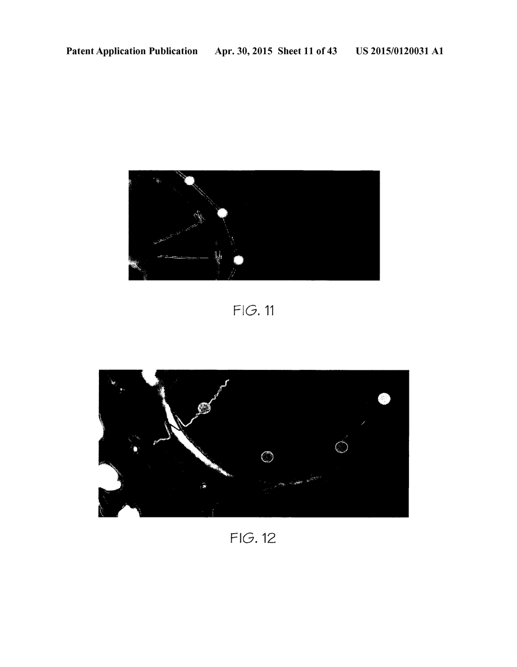 METHOD OF GENERATING A PATIENT-SPECIFIC BONE SHELL - diagram, schematic, and image 12