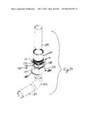 EXTENDABLE SLEEVE FOR POURED CONCRETE DECK diagram and image