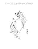 EXTENDABLE SLEEVE FOR POURED CONCRETE DECK diagram and image