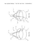 BIRD FEEDER HANGER ASSEMBLY diagram and image