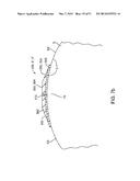 SYSTEM AND METHOD FOR CONTROLLING THE IONTOPHORETIC DELIVERY OF     THERAPEUTIC AGENTS BASED ON USER INHALATION diagram and image