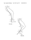 ACTUATION OF A BODY-BORNE SWITCH BY A BODY GESTURE diagram and image