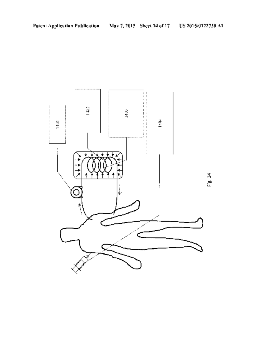 Blood Cleansing System & Method - diagram, schematic, and image 15