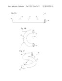 TUBULAR RACETRACK diagram and image