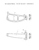 Wheel-Unit-Ready Ski for Ski-Mounted Vehicle diagram and image